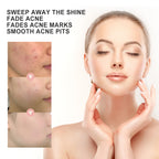 Hydrocolloid Acne Patch