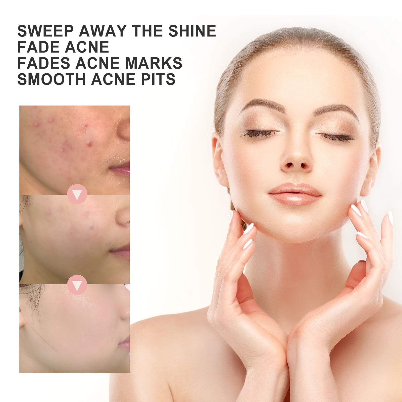 Hydrocolloid Acne Patch