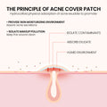 Repair Acne Patch (200-Pack)
