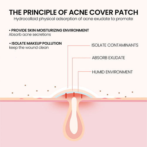 Repair Acne Patch (200-Pack)